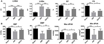 Multipronged Therapeutic Effects of Chinese Herbal Medicine Qishenyiqi in the Treatment of Acute Myocardial Infarction